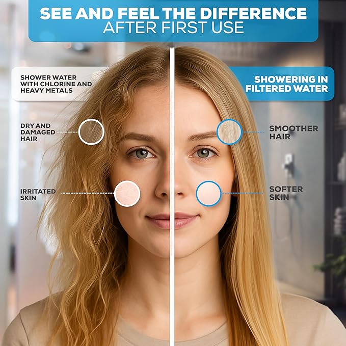 SparkPod 23-Stage Filtered Shower Head, 8" Round, Brushed Nickel | Filtered Shower Head for Hard Water Filter, High Pressure, Reduces Chlorine, Heavy Metals, For Dry Skin & Hair
