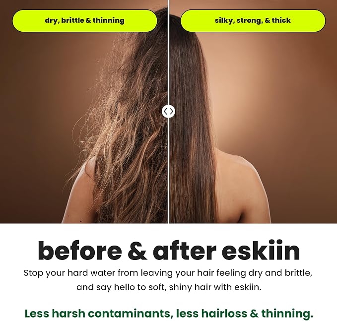 Eskiin Filtered Shower Head - Best Shower Head With Filters For Healthy Hair & Skin - High Pressure Water Softener For Hard Water - Reduce Dandruff, Protect Colored Hair, And Soothe Dry Skin (Black)