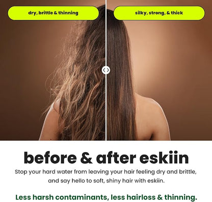 Eskiin Filtered Shower Head - Best Shower Head With Filters For Healthy Hair & Skin - High Pressure Water Softener For Hard Water - Reduce Dandruff, Protect Colored Hair, And Soothe Dry Skin (Black)